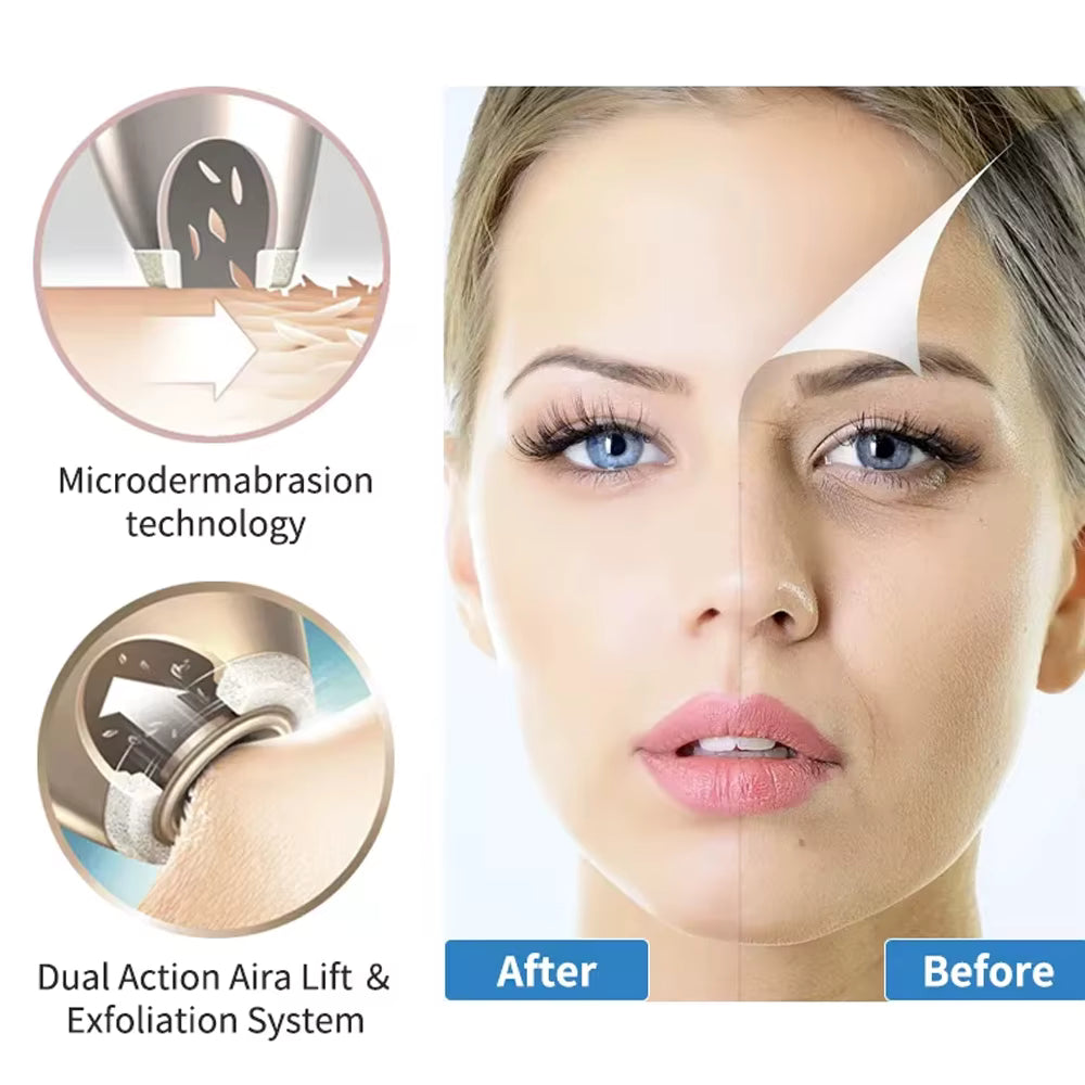 DermaPolish™ - Diamond Skin Resurfacing Wand