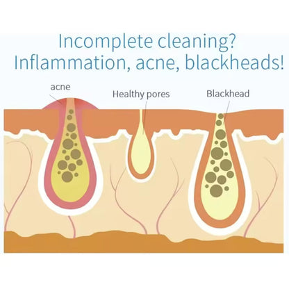 HydraGlow™ Deep Pore Cleansing Facial Device