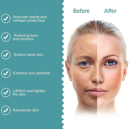 RadianceLift™ 3-in-1 Skin Sculpting Device