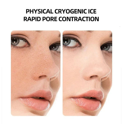 CryoLift™ Hot & Cold Facial Sculpting Device