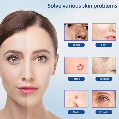 PlasmaLift™ Skin Tightening Pen