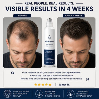 HairRevive™ - Hair Growth Roll-On Serum