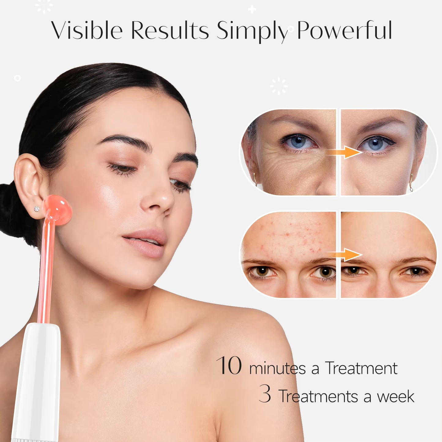 DARSONVAL™ High Frequency Skin Wand