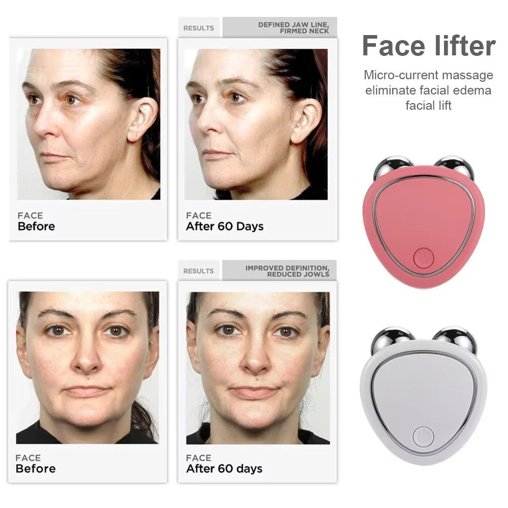VORA™ - Electric Facial Lifting Roller