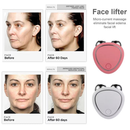 VORA™ - Electric Facial Lifting Roller